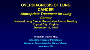 Overdiagnosis Of Lung Cancer Presentation photo cover
